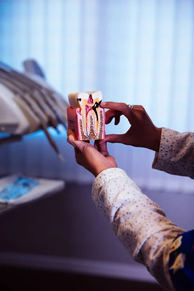 Manos sosteniendo un modelo de diente humano con caries dental —  Fotos de Stock