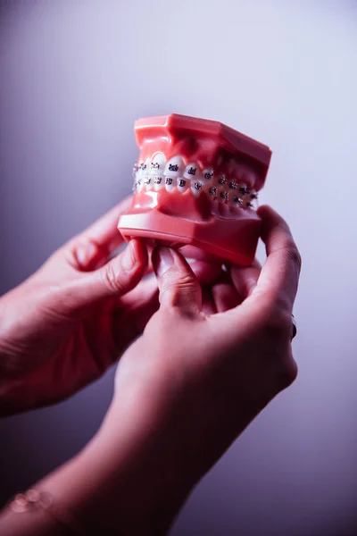 Manos que sostienen el modelo de mandíbula humana con frenos dentales —  Fotos de Stock