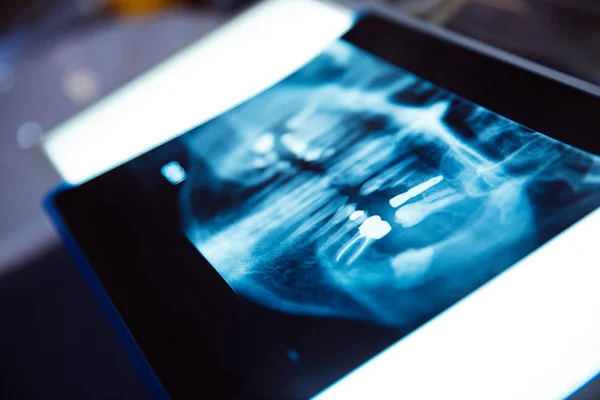 Mujer dentista observando una radiografía de la boca en la clínica — Foto de Stock