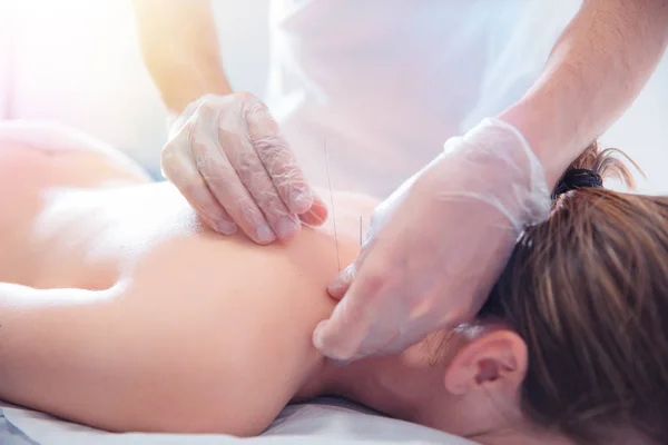 Fizjoterapeuta robi akupunktury do młodej kobiety na plecach — Zdjęcie stockowe