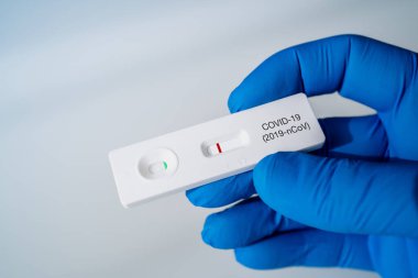 Doktor, COVID-19 için COVID-19 2019-NCoV virüsünün test kitini elinde tutuyor. Coronavirus SARS-CoV-2 virüsü için laboratuvar kartı testi. Hızlı test COVID-19.