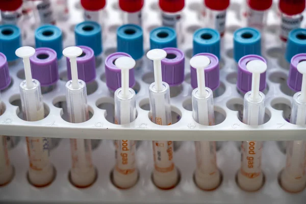 Speciální Injekční Lahvičky Krevními Testy Virus Zblízka — Stock fotografie
