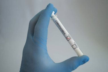 Bir tıp uzmanının elinde koronavirüs testi yapılan bir tüp.
