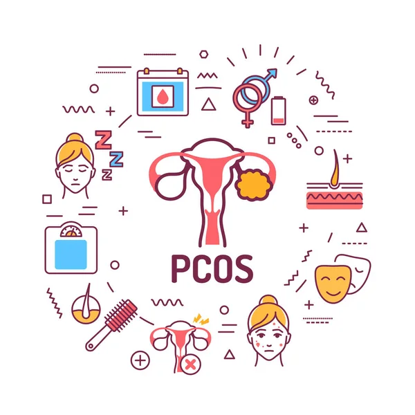 PCOS belirtileri web pankartı. Kadın üreme sistemi hastalığı. Kırmızı arkaplanda doğrusal simgeleri olan bilgi grafikleri. İzole edilmiş dış hat renk çizelgesi.