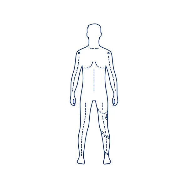 Man Artificial Leg Black Line Icon Person Who Has Prosthesis — Stock Vector