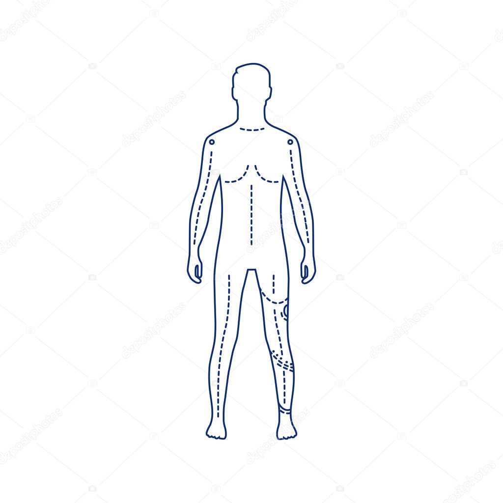 Man with artificial leg black line icon. Person who has a prosthesis instead of a real leg. Pictogram for web page, mobile app, promo. UI UX GUI design element. Editable stroke.