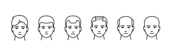 头发脱落阶段黑线图标 一个人头上的毛发数量逐渐减少的阶段 移动应用 宣传用的象形文字 Gui设计元素 可编辑笔划 — 图库矢量图片