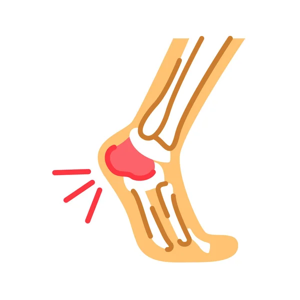 Foot Heel Pain Flat Color Icon Heel Spur Calcaneal Apophysitis — Stock Vector