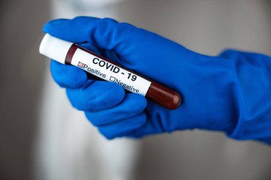 A nurse s hand in a glove holds a test tube with the inscription COVID 19, with a positive blood test for a new rapidly spreading coronavirus, close-up, shallow depth of field, selective focus