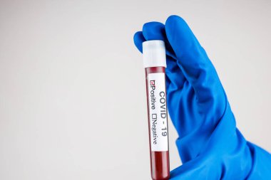 A nurse s hand in a glove holds a test tube with the inscription COVID 19, with a positive blood test for a new rapidly spreading coronavirus, close-up, shallow depth of field, selective focus