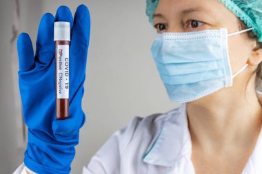 A nurse in a respiratory mask holds a test tube labeled COVID 19, with a positive blood test for a new rapidly spreading coronavirus, close-up, shallow depth of field, selective focus. The concept of