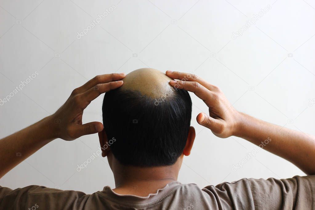 bald man in isolated white background worried and both hands on 
