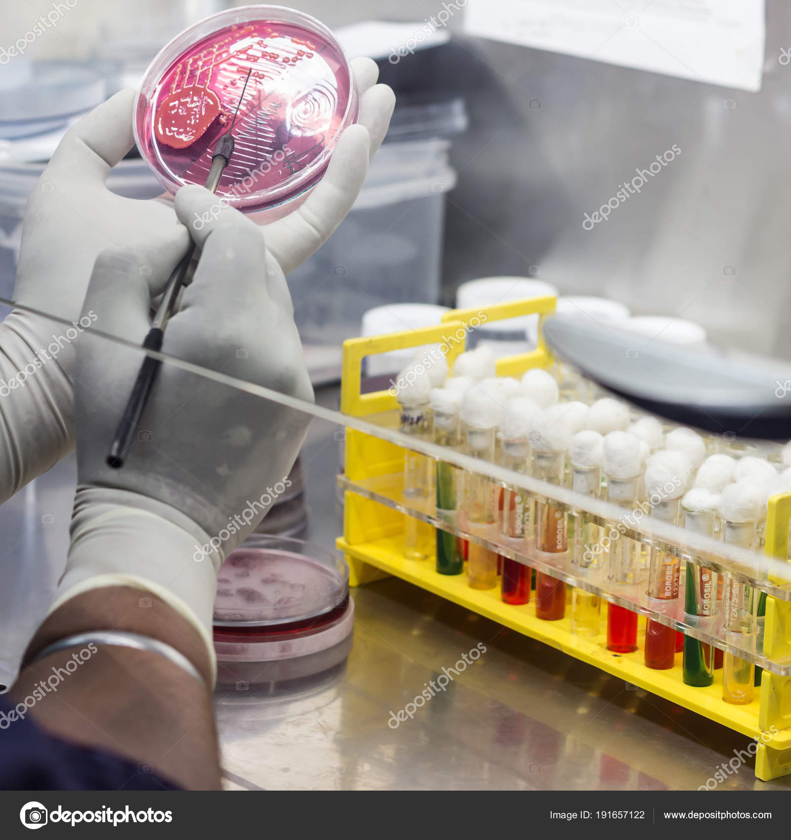 Resultado de imagen para inoculacion