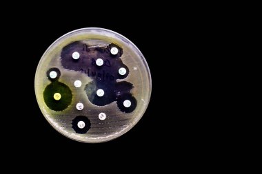 Kültür plaka siyah arka planda izole onların koloni desen antibiyotik duyarlılık gösteren Bakteriyel büyüme