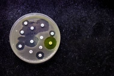 Siyah arka planda izole onların koloni desen antibiyotik duyarlılık gösteren bakteriyel growh kültür tabak Üstten Görünüm
