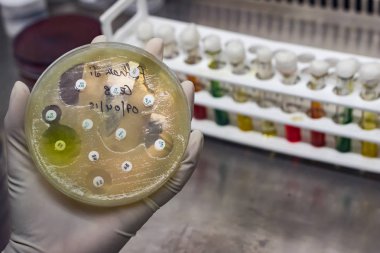 Üstten Görünüm kültür plaka bakterilerin büyüme onların koloni desende antibiyotik duyarlılık gösteren hadım eldivenli elinde yerleştirilen