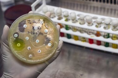 Top view of Culture plate of bacterial growth showing antibiotic sensitivity in their colony pattern placed geld in gloved hand clipart