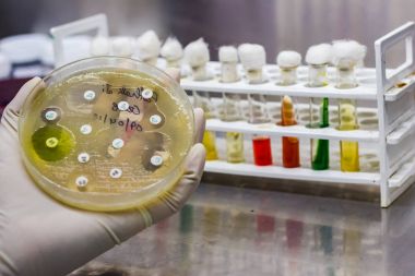 Kültür plaka bakterilerin büyüme onların koloni desende antibiyotik duyarlılık gösterilen yan görünüm hadım eldivenli elinde yerleştirilen