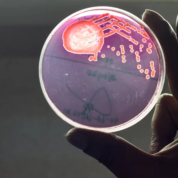 Baktérium tenyészetet lemez mutatja a baktérium kolónia növekedése a mac conkey vér-agarra tartott kézzel — Stock Fotó
