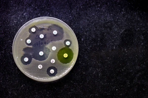 Siyah arka planda izole onların koloni desen antibiyotik duyarlılık gösteren bakteriyel growh kültür tabak Üstten Görünüm
