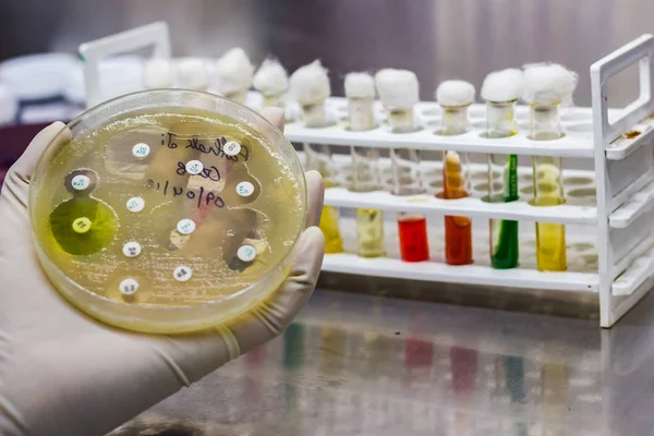 Vista lateral da placa de cultura de crescimento bacteriano mostrando sensibilidade antibiótica em seu padrão de colônia colocado solda na mão enluvada — Fotografia de Stock