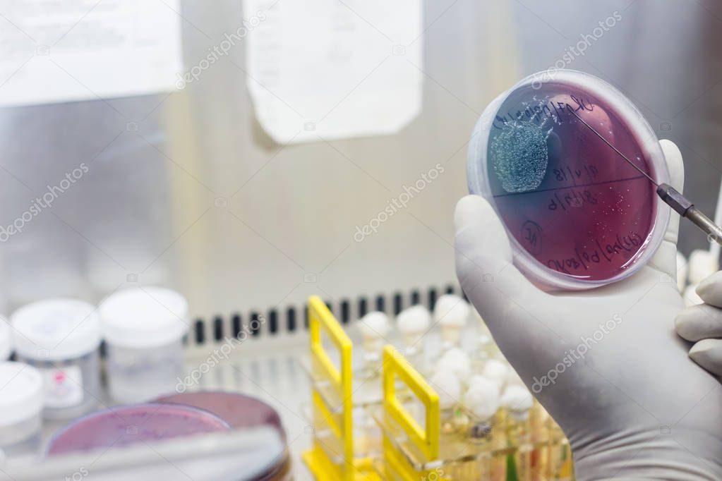 Inoculation on blood agar on a culture plate using inoculation loop by scientist inside fume hood in microbiology laboratory