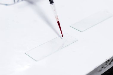 damla kan micropipette microtip kullanarak bir cam slayt üzerinde