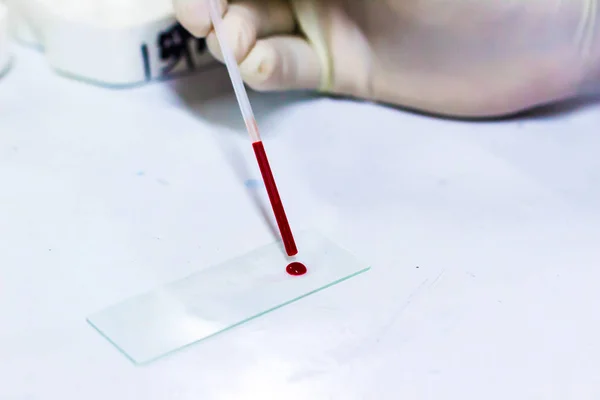 Científico arrojando una gota de sangre en un portaobjetos de vidrio — Foto de Stock