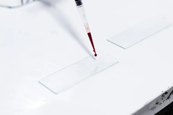 Gota de sangre en un portaobjetos de vidrio utilizando micropipeta microtip — Foto de Stock