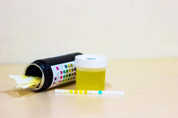 Urine monster samen met dip stick uristix voor het analyseren van urine glucose eiwit bij diabetes — Stockfoto