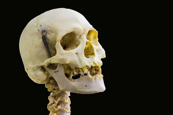 Osso Crânio Humano Articulado Vértebras Cervicais Para Anatomia Cabeça Pescoço — Fotografia de Stock