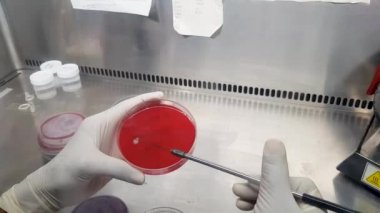 Aşılama döngüsüyle kan tarımı kültüründe irin örneğinin aşılanması.