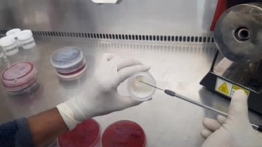 Aşılama döngüsü kullanarak örnek kabından irin örneği alınıyor.