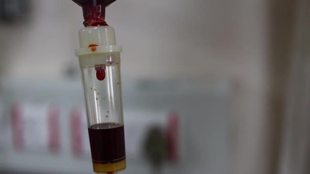 Closeup shot of dripping blood in a transfusion set during blood transfusion and iron transfusion — Stok Video