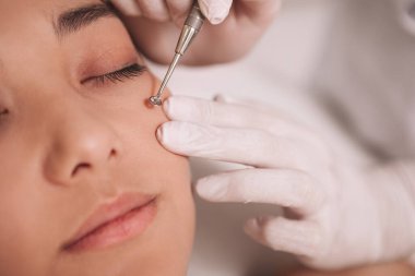 Kaplıcadaki profesyonel kozmetik uzmanı tarafından siyah noktalar ve sivilceler alınmış genç bir Asyalı kadının yakın plan fotoğrafı.