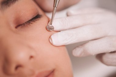 Siyah başlık çıkarıcı kullanan bir dermatoloğun yakın plan fotoğrafı. Kadın bir müşterinin yüzünü temizliyor.