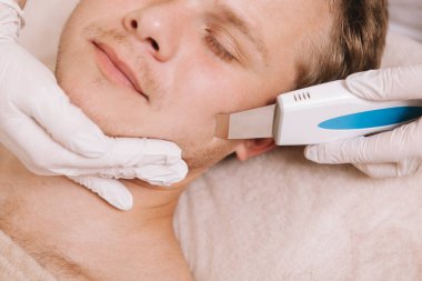Dermatolog cildinde ultrason temizleme cihazı kullanırken genç ve yakışıklı bir adamın rahatlamasının yakın plan görüntüsü.