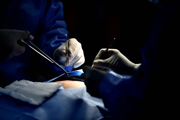 Lékařský Tým Chirurgické Operace Moderním Operačním Sále Zařízení Zdravotnické Prostředky — Stock fotografie