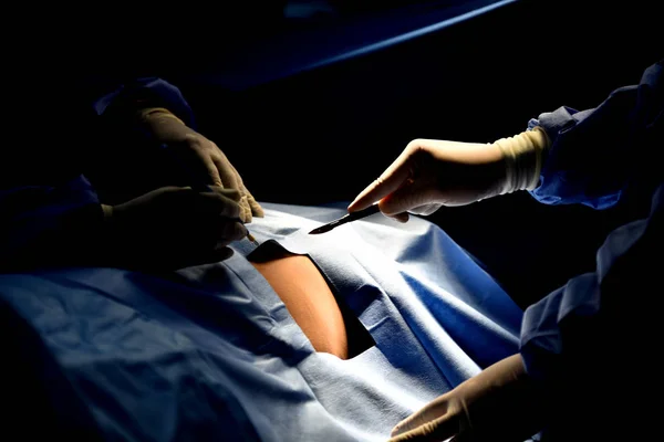 Zespół Medyczny Operacji Chirurgicznych Nowoczesnej Sali Operacyjnej Sprzęt Urządzenia Medyczne — Zdjęcie stockowe