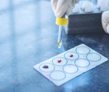 Yakın çekim, Abo Kan Protokolü adlı Kan Testi grubu, Antisera 'yı cam kaydıraktaki kan damlalarına eklemek,.