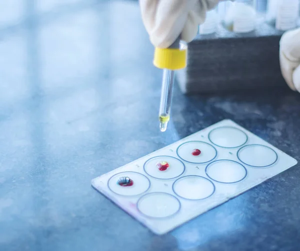De aproape, Mâinile de testare Grupa de sânge numită Protocol de grupare sau testare a sângelui ABO, Adăugarea Antisera la picăturile de sânge pe diapozitivul de sticlă . — Fotografie, imagine de stoc