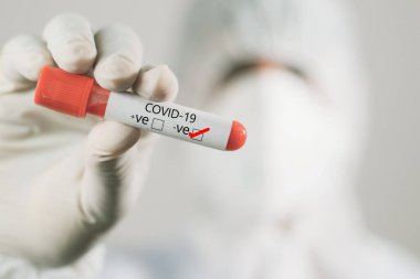 Doktor elinde negatif Coronavirus kan testi tüpü, covid-19 veya 2019-nCoV laboratuarında..
