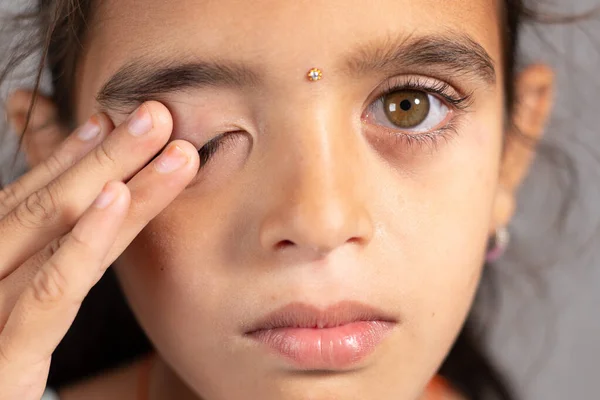 Extreme close up of child rubbing her eyes - concept showing to prevent and Avoid touching your eyes. Protect from COVID-19 or coronavirus infection or outbreak - Don t Touch Your eyes. — Stock Photo, Image