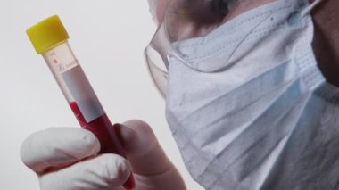  Kan örneği tutan bir doktorun yakın çekimi.
