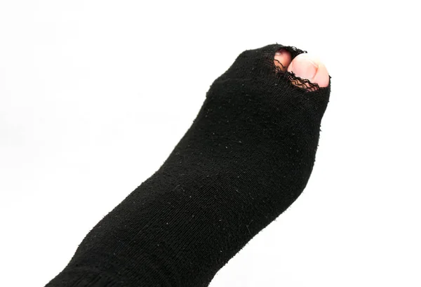 Foot in old sock and torn — Stock Photo, Image