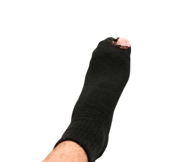 Ayak eski çorap ve beyaz arka plan üzerinde yırtık