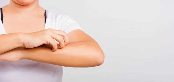 Asiática Hermosa Mujer Picazón Uso Mano Rasguño Picazón Brazo Sobre — Foto de Stock