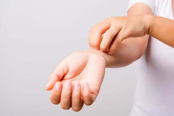 Asian Beautiful Woman Itching Her Useing Hand Scratch Itch Hand — Stock Photo, Image