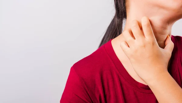 Asian Beautiful Woman Itching Her Scratching Her Itchy Neck White — Stock Photo, Image