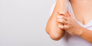 Asyalı güzel bir kadın elini kaşıyarak kaşınıyor beyaz arka planda fotokopi alanı, sağlık ve sağlık hizmetleri konsepti ile kollarını kaşındırıyor.